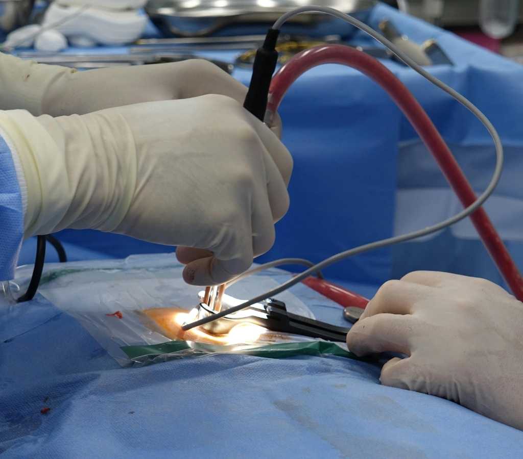surgery
